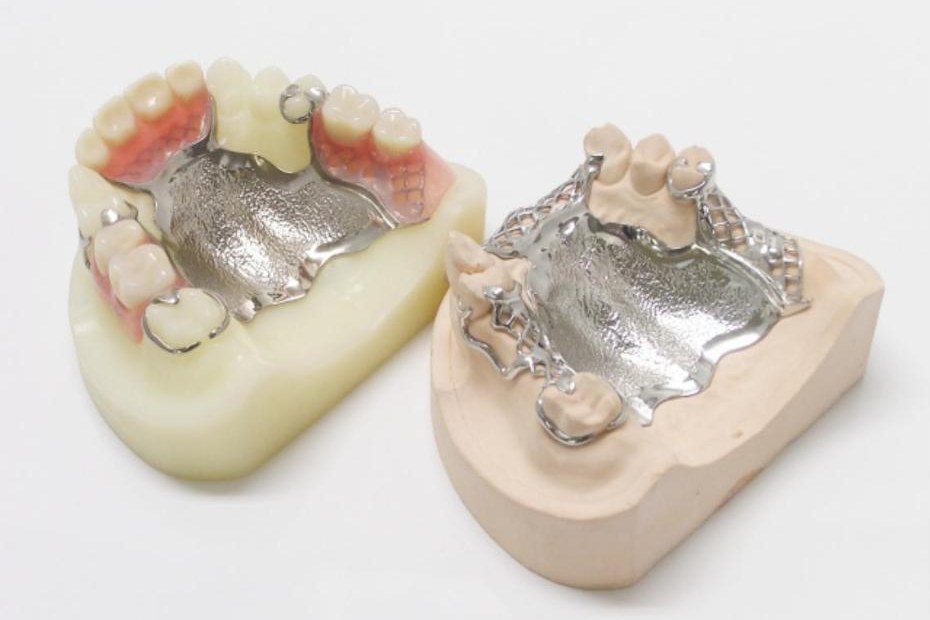 金属床の入れ歯